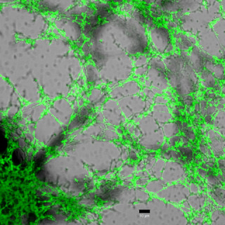 網目状の「マイクロフィブリル」の蛍光顕微鏡像＝理化学研究所提供